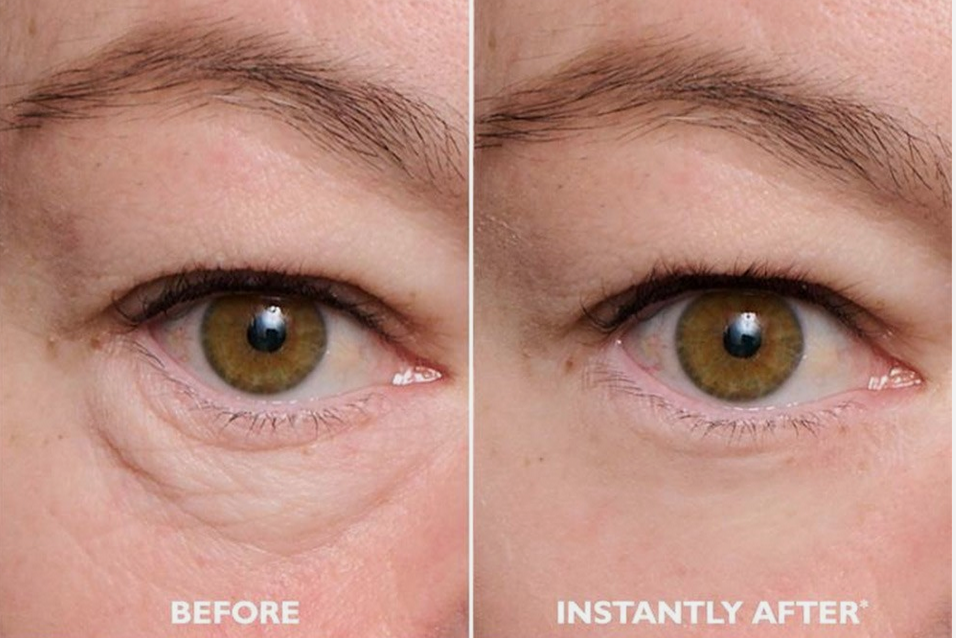 Norea Beauty - Temporäre Augenstraffungscreme